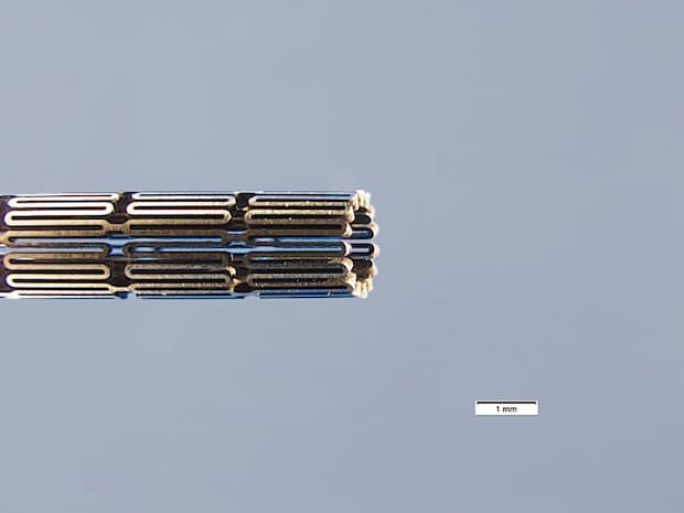 Detail of a Nitinol stent