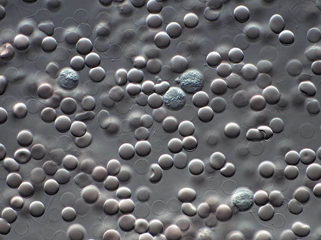 Human blood