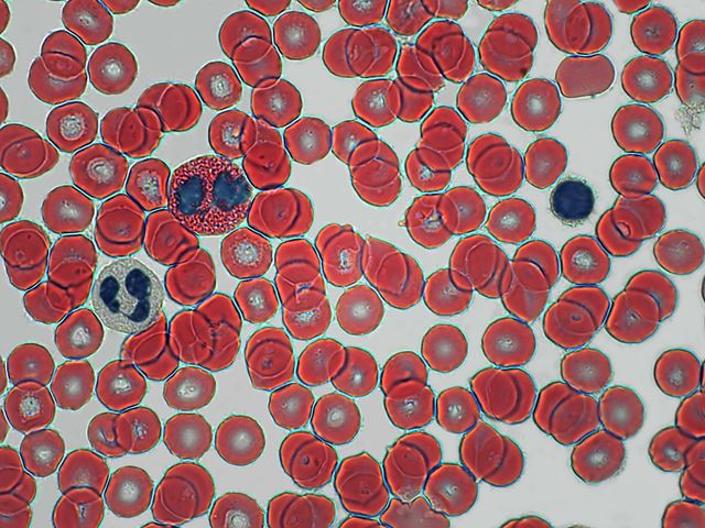 Human blood smear