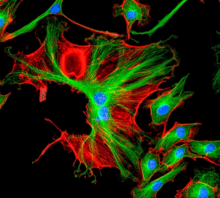 3-channel fluorescence microscopy (red, green, blue)