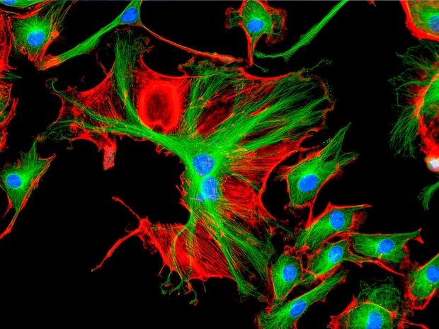 3-channel fluorescence microscopy (red, green, blue)