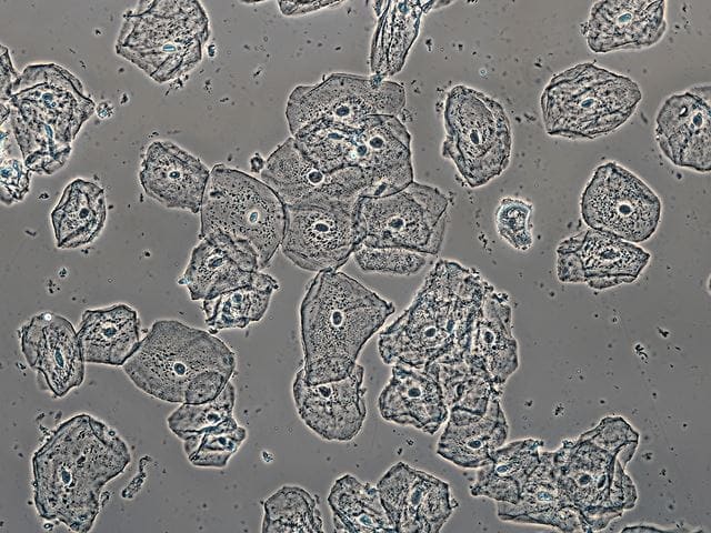 Oral mucosal membrane cells (brightfield)