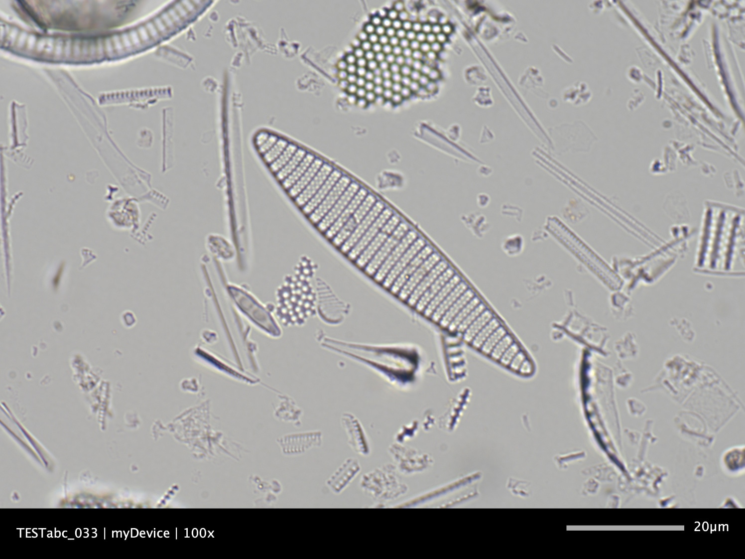 Microscope image
