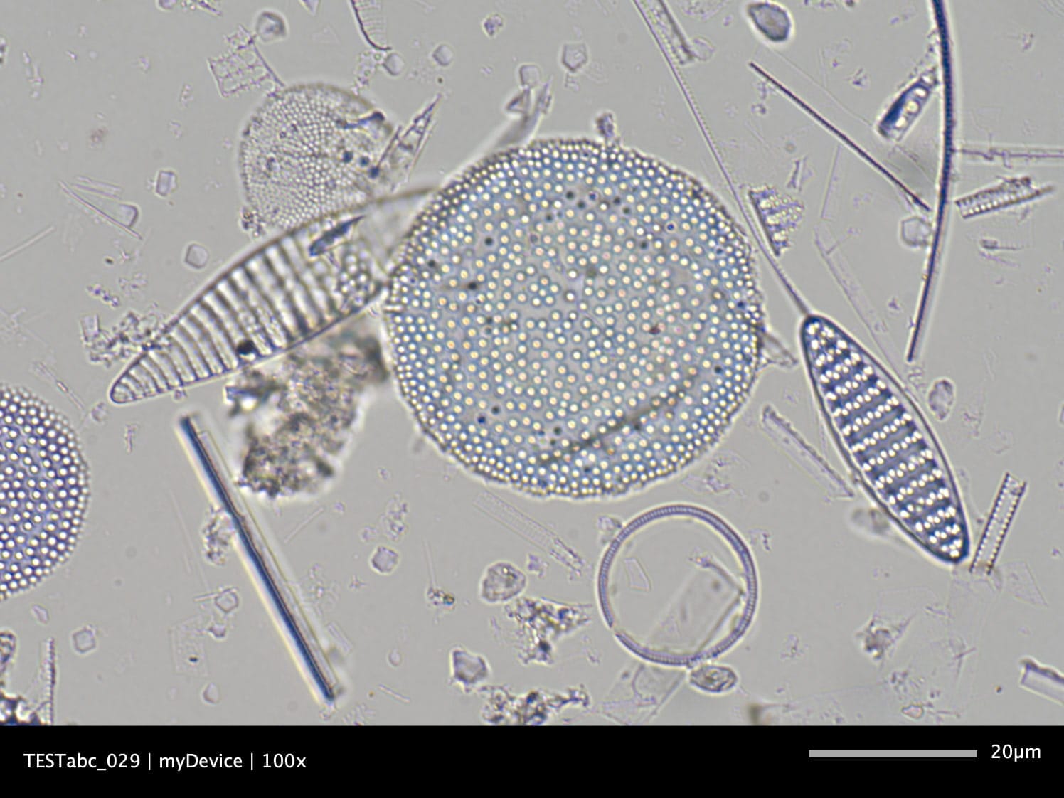 Microscope image