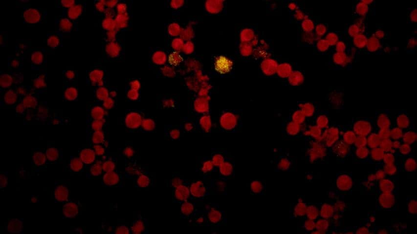 GYPHAX image of hematological cell sample