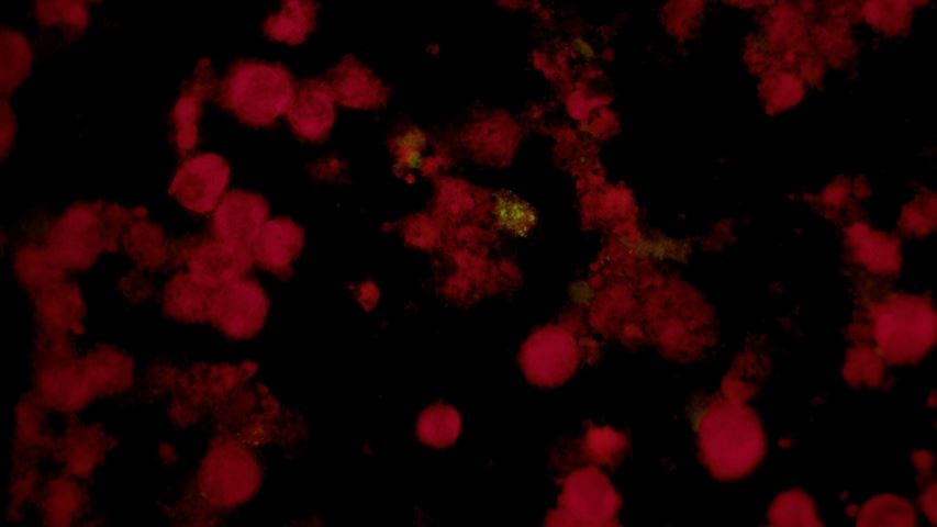 GYPHAX image of hematological cell sample