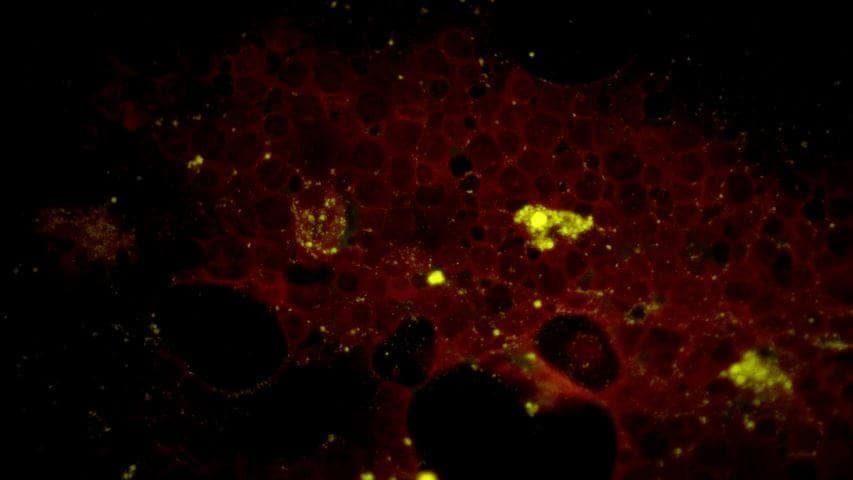 GYPHAX image of hematological cell sample