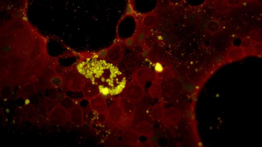 GYPHAX image of hematological cell sample