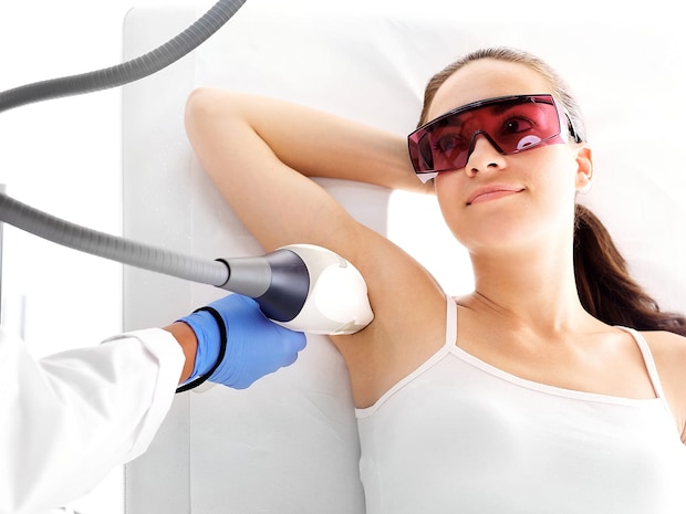 Laser hair removal of armpit hair